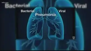 Ways you can avoid pneumonia