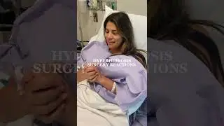 Hyperhidrosis surgery reactions 🤞🏼💙 #excessivesweating #hyperhidrosis #sweatyhands #sweat