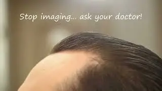 Ask your Doc Spot 02 hair loss 01