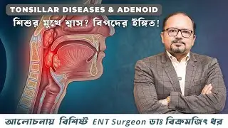 Tonsils or Adenoids? When is surgery necessary? Eminent ENT Surgeon Dr. Vikramjit Dhar in discussion
