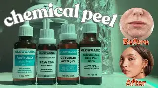Chemical Peel At Home || Chemical Peel Treatment || skin peeling