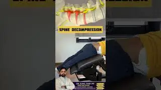 Spine decompression for Disc herniation recovery #drsuniltank #physiopoint #backpain