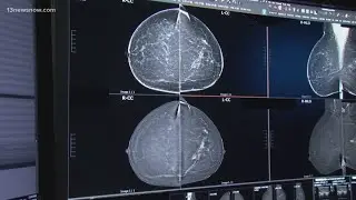 Reaction to new breast cancer screening recommendations