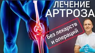 Приём пациента с болями в коленях. Лечение методом P-DTR.  #артрозколена #артрозсуставов 