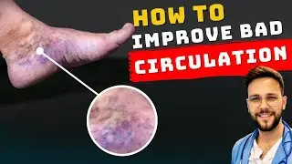 HOW TO INSTANTLY IMPROVE THE CIRCULATION OF SWOLLEN LEGS AND FEET
