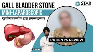 Best Hospital for Gall Bladder Stone in Ludhiana | Best Gall Bladder Doctor | Gall Bladder Treatment