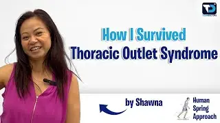 My Hand Turned Purple — The Hidden Danger of Thoracic Outlet Syndrome (TOS)