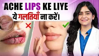 Lips pe Vitiligo क्यों फैलता है ? Common Mistakes & Care Tips