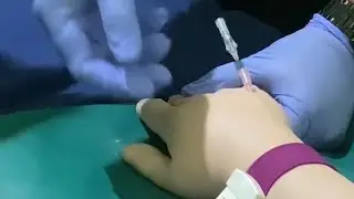 Osce pemasangan infus part 2 (06/07-2025)
