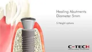 BONE LEVEL prosthetic