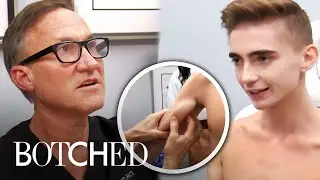 Implants That Literally Flip on 