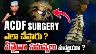 ACDF Surgery | Risks & Recovery | Complications of ACDF surgery in telugu | Dr GPV Subbaiah