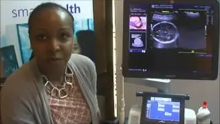 New ultrasound machine from GE to improve diagnosis