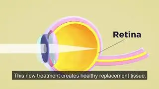 Reversing the Course of Vision Loss