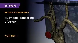 3D Image Processing of Artery in Simpleware
