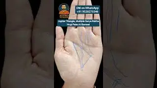 Jupiter Triangle ✨ + Multiple Surya Rekha 👉 Fame & Success Guaranteed! #palmistry #astrology