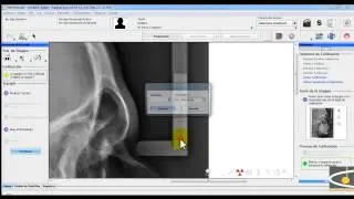 Tutorial de software de ortodoncia : Nemoceph (Audio)