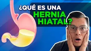 ¿QUÉ ES UNA HERNIA HIATAL?
