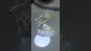 Dental Loupes Magnification for teeth surgery