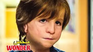 ولد بوجه مشوه والكل يتنمر عليه😢...لكن طيبة قلبه❤️ ستغير كل شي✨|ملخص بدارجة