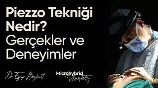 Piezzo Tekniği Nedir? Ger&ccedil;ekler ve Deneyimler | @dreyupbozkurt
