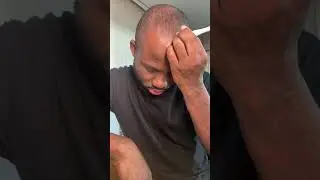 Micro needling technique Hair growth journey #hairregrowthjourney