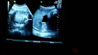 video vincent 35sa+6jours   Copie