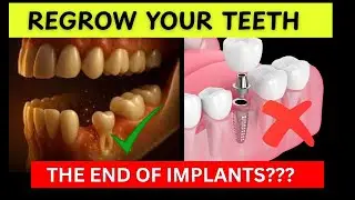 Regrow your teeth | End of Implants?? #dental #implants #dentalcare 