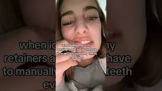 Can Your Straighten Your Teeth With Your FINGER?! 🤔🦷