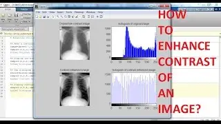 MATLAB histogram equalization.avi