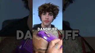 How to get rid of dandruff 😱