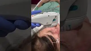 HIFU treatment