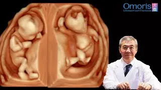 Детские танцы на 4D УЗИ Live!!!