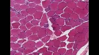 Histopathology Muscle, skeletal--Muscular dystrophy
