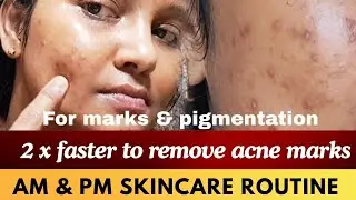 ✅️ Must Try this serum to reduce acne marks & pigmentation 2 times faster #acne #darkspots #pimple 