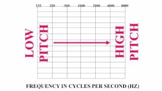 Example Audiogram