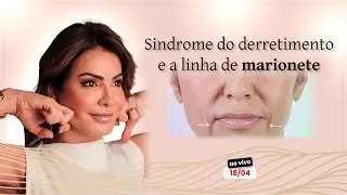 Síndrome do derretimento e a linha de marionete