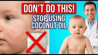 STOP Using Coconut Oil on Baby Acne! (The Dangerous Myth)