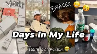 LIVING IN CHINA:DENTIST|VENTING|SCHOOL TRIP