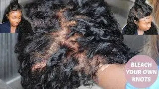 BLEACH KNOTS ON A FULL LACE WIG TUTORIAL | WIG ENCOUNTERS
