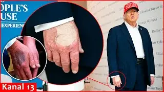 Trump's health is becoming increasingly mysterious: US President will make an announcement today