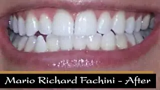 Mario Richard Fachini - A Pleasant Experience