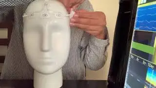 Colocación del sensor Masimo SedLine RD