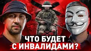⚠️ Жизнь после ампутации: история бойца, потерявшего ноги на войне
