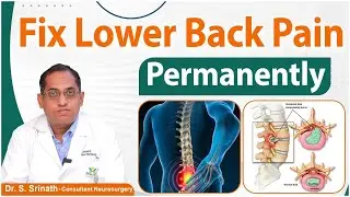 How to Fix Lower Back Pain Permanently || Lumbar Disc Prolapse || Lower Back Pain Causes || Renova