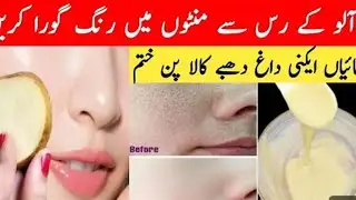Alo Sy rang gora krny ka tarika # gram flour face mask for skin whitening#  ezza kitchen and hacks#