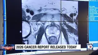 American Cancer Society provides projections for 2026