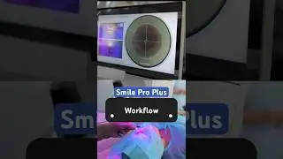 Planning a Laser Vision Correction, then this Smile Pro Advance workflow is a must watch!