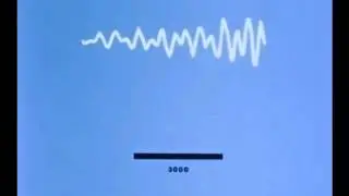 Antenna Theory Bandwidth