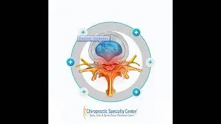 Prolapsed Disc: A Simple Explanation